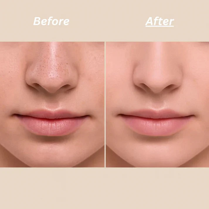 Dr Melaxin™ Peel Shot Ampoule (Extra 65% Off 🎉)