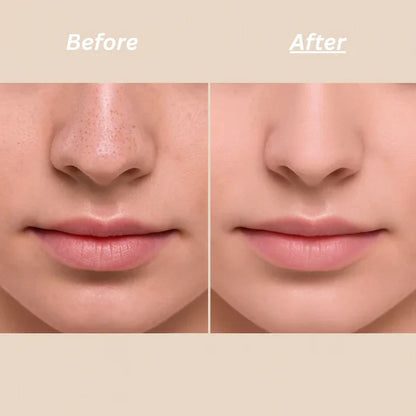 Dr Melaxin™ Peel Shot Ampoule (Extra 65% Off 🎉)