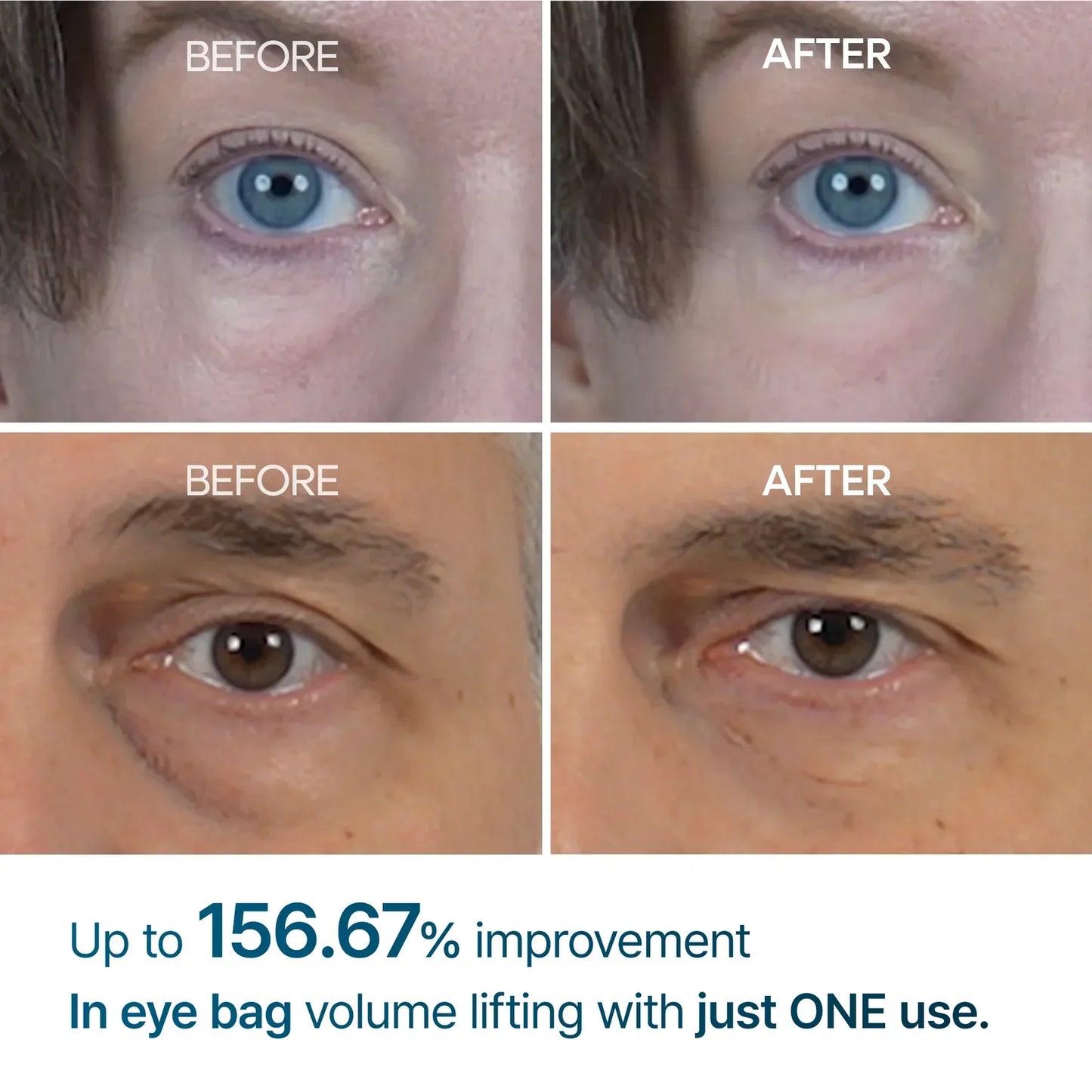 Dr Melaxin™ Eyephalt eyebag cream